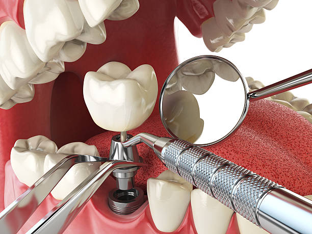 Professional Emergency Dentist in MT